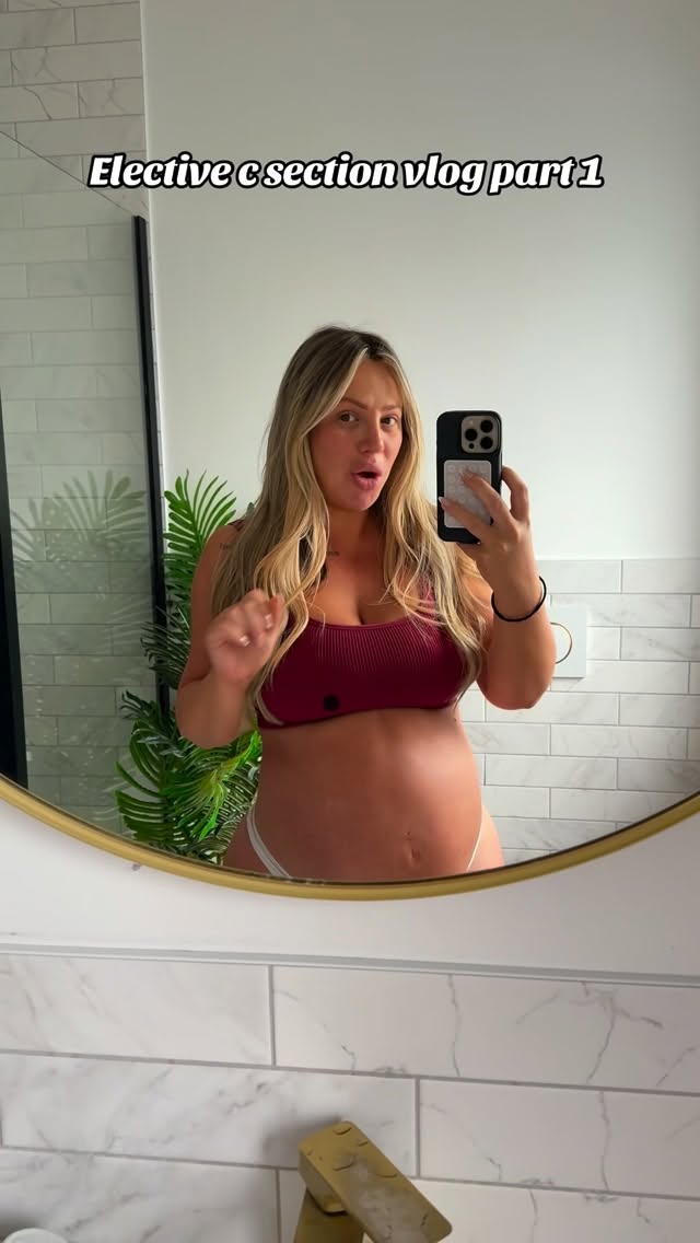 Elective c section vlog ✨

unfortunately this day didn’t quite go to plan so there will have to be a part 2 🥲